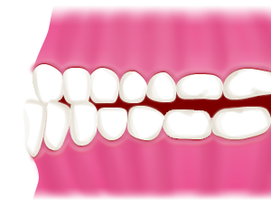 あなたが気になる歯の並びはどのようなものでしょうか？