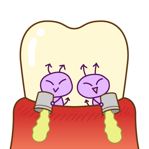 歯ぐきから膿が出ている原因とは？
