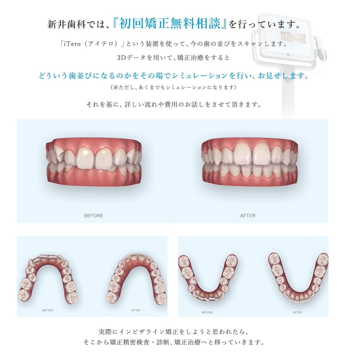 新井歯科では、『初回矯正無料相談』を行っています。