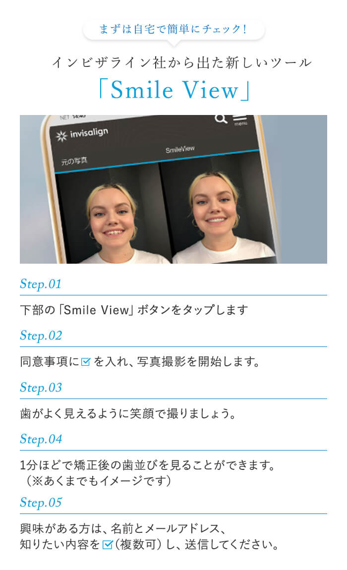 インビザライン社から出た新しいツール「Smile View」