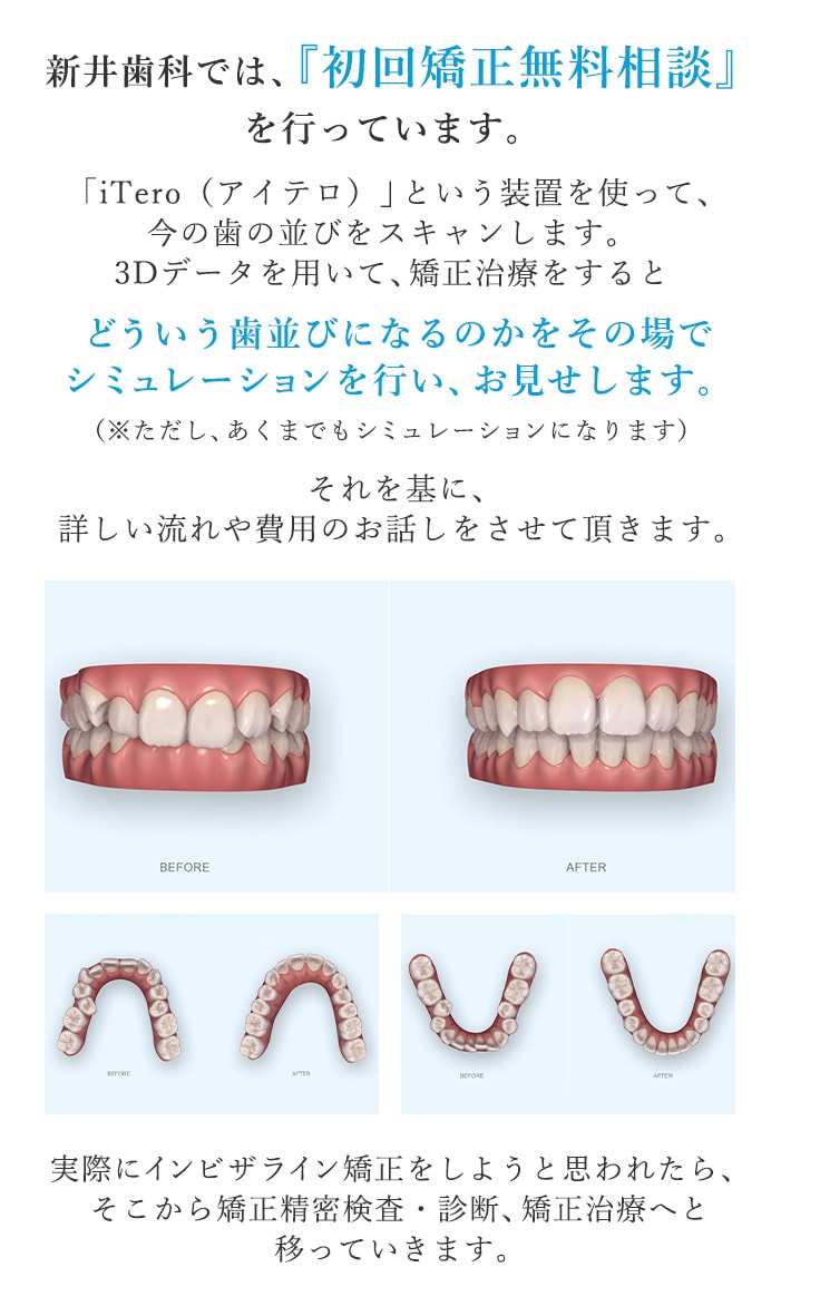 新井歯科では、『初回矯正無料相談』を行っています。